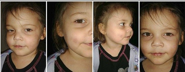 Fotografie malé Leiliany se zraněními od týrání jsou strašlivé