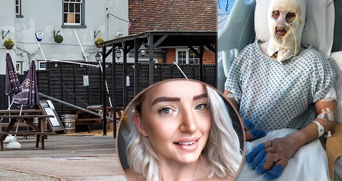 Maminku popálil ohřívač: Opilec do něj „ze srandy“ nalil líh!