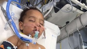 Malý Samík utrpěl popáleniny a srdeční zástavu po vypití louhu.