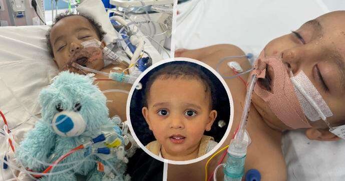 Malý Samík utrpěl popáleniny a srdeční zástavu po vypití louhu.