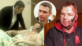 Vitalij Kličko navštívil v nemocnici aktivistu, který utrpěl při únosu děsivá zranění