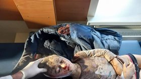 Šestiletá Tanja Morozová se ukrývala s maminkou ve sklepě v Mariupolu před ruskými bombami. Holčička bombardování nepřežila.