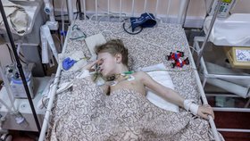 Tříletý chlapec zraněný při útoku na Mariupol (29.3.2022)