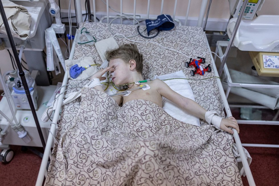 3years old boy injured during shelling of Mariupol / Tříletý chlapec zraněný při útoku na Mariupol (29.3.2022)