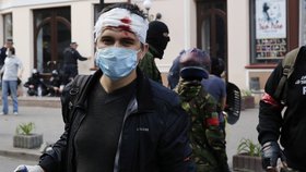 Proruský aktivista utržil při bojích zranění.