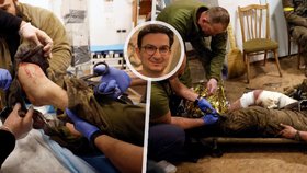 Naděje pro Ukrajince, které Putinova válka připravila o nohy? Na Ukrajinu dorazil vyhlášený doktor