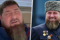 Smrt Kadyrova by se neututlala, míní analytik. „Každému je jasné, že je chorý,“ říká exagent
