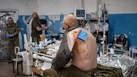 „Ukrajinský M.A.S.H.“ a jeho šéflékař Viktor: Slepíme zraněné a pošleme je dál