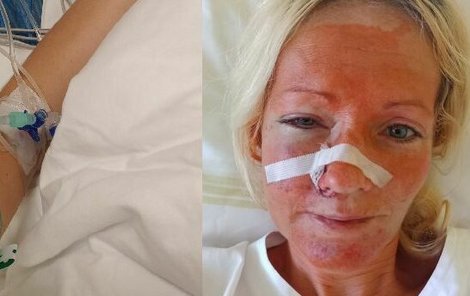 Ukrajinka Lilia skončila po napadení v nemocnici se zlomeninami v obličeji. 