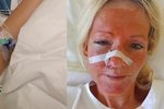 Ukrajinka Lilia skončila po napadení v nemocnici se zlomeninami v obličeji.