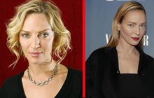 Další oběť plastik: Uma Thurman k nepoznání!