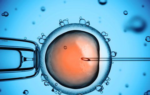 Polku při zákroku oplodnili cizím vajíčkem, dítě je postižené