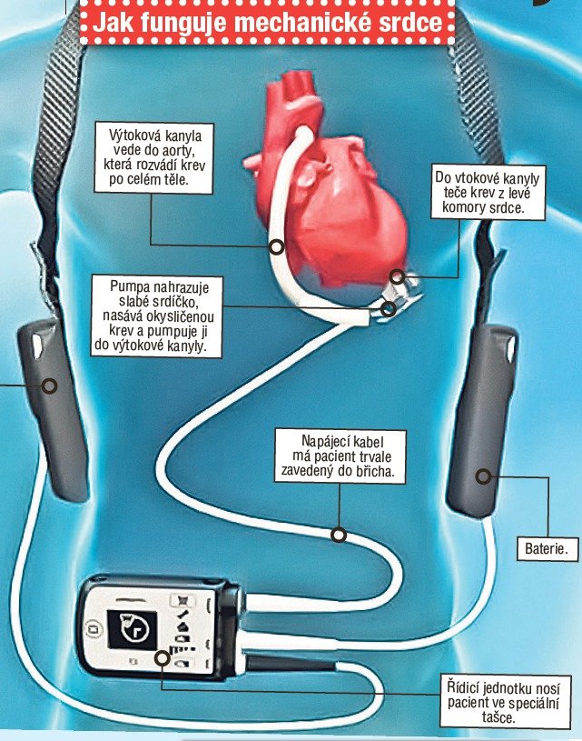Takto umělé srdce funguje.