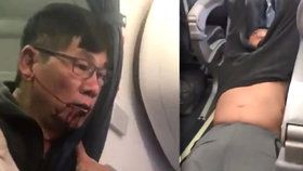 Na palubě United Airlines zbili lékaře Davida Daa.