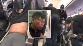 Šéf aerolinek United Airlines pochválil své podřízené za brutální zákrok.