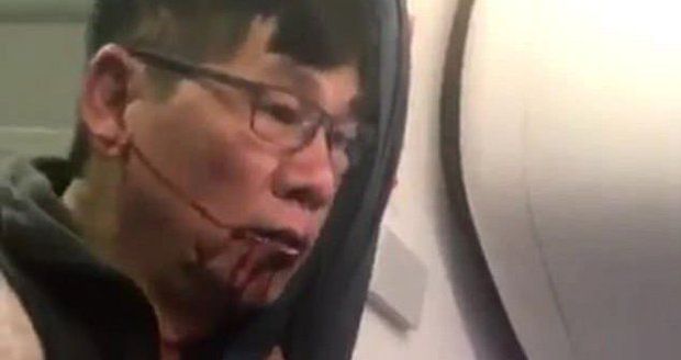 Za brutální vyhazov z letadla žaloba: Lékař se chce soudit s United Airlines