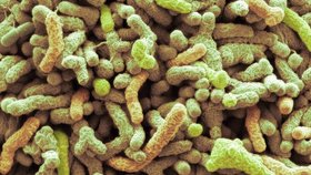 Bacilární úplavice (Shigella sonnei)