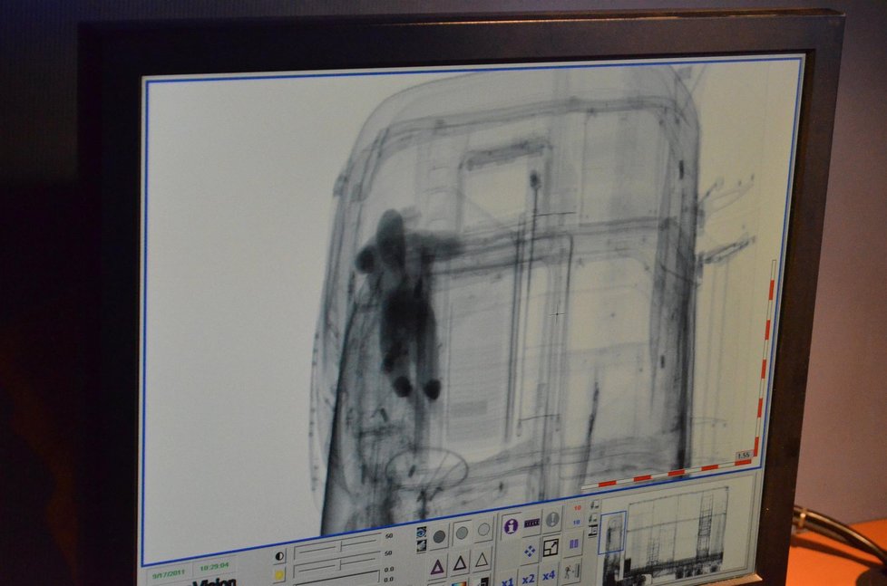 Obraz, který se na monitoru ukáže obsluze rentgenu