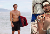 Kvůli infekci přišel o plíci a o nohu: Pak se vášnivý surfař nakazil zákeřným koronavirem