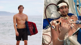 Kvůli infekci přišel o plíci a o nohu: Pak se vášnivý surfař nakazil zákeřným koronavirem