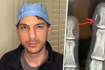 Americký chirurg Nick Pappas dal na sociální síti lidem nahlédnout do své práce.