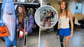 Anabelle (16) přežila útok dvou žraloků, prala se s nimi pěstmi.