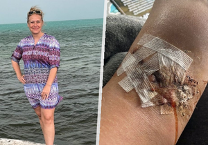 Heather Westová (35), která unikla ze zubů dvoumetrového žraloka: Přišla jsem si jako v Čelistech!