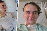 Hrůzný útok v McDonaldu: Mladíkovi (20) chrstli olej z friťáku do tváře
