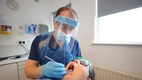 Může koronavirus způsobit vypadávání zubů? Lidé s dlouhodobým koronavirem se podělili o své zubní problémy, (ilustrační foto).