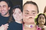 Connie Culp znetvořil vlastní manžel, v roce 2008 prošla náročnou transplantací obličeje. Nyní v 57 letech zemřela.
