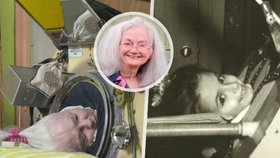 Martha Lillardová (†78): Poslední Američanka v železných plicích