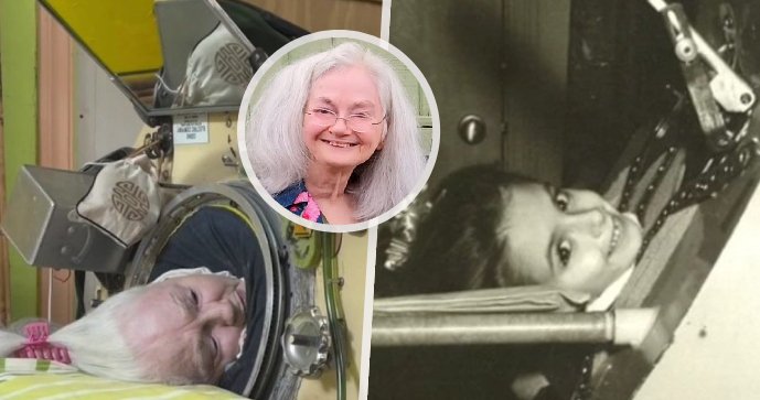 Martha Lillardová (†78): Poslední Američanka v železných plicích