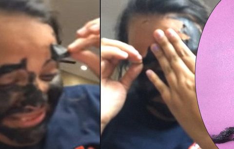Dívka při odstraňování pleťové masky přišla o obočí! Nepřečetla si návod