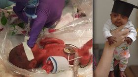 Saybie se narodila ve 23 týdnech, přes děsivé prognózy lékařů přežila a těší se dobrému zdraví.