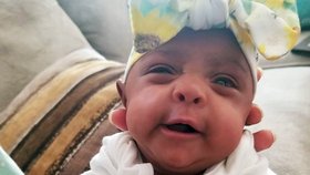 Saybie se narodila ve 23 týdnech, přes děsivé prognózy lékařů přežila a těší se dobrému zdraví.