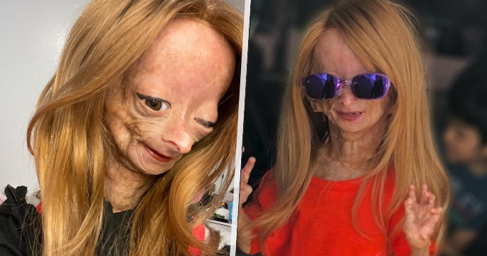 Zemřela hvězda Youtube Adalia Roseová (†16).