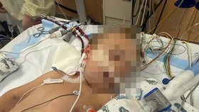 Výlet do hor skončil pro děti podchlazením a hospitalizací.