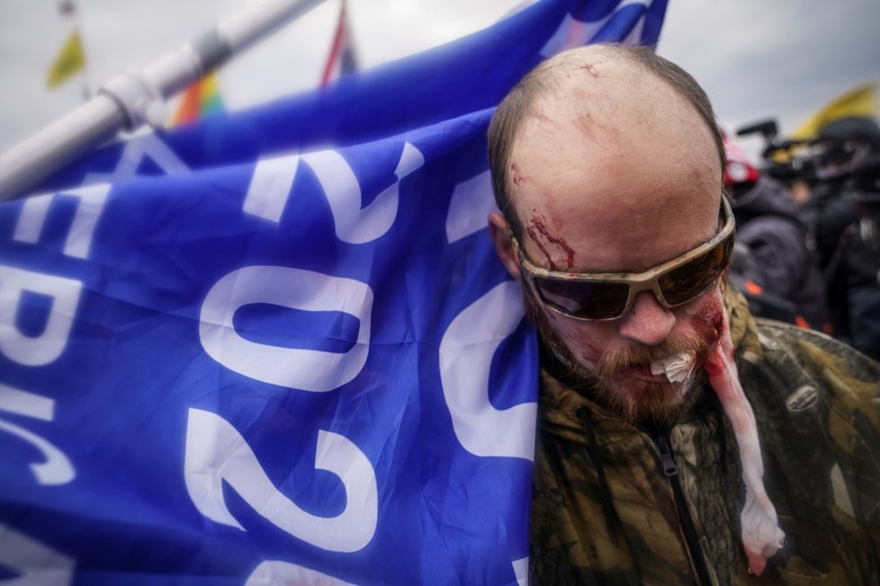 Trumpovi příznivci se střetli s policií.