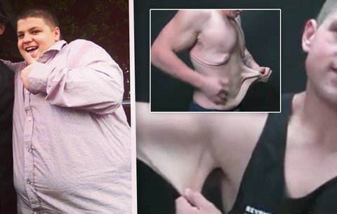 Děsivé video: Neuvěřitelně zhubnul a teď na něm visí metry kůže!