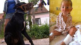 Pes pokousal holčičku i její mámu. Dítě lékařka uspala kvůli bolestem