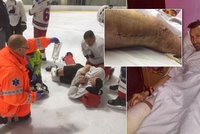 Dýdžej Uwa se zranil na ledě: Otevřená zlomenina a operace!