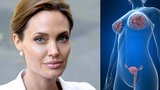 Angelina si po prsou nechala odstranit i vaječníky: Nechte se otestovat, možná to lékaři doporučí i vám