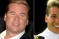 Val Kilmer v nemocnici: Herci objevili velký nádor v krku!