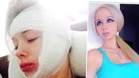 Valeria Lukyanova byla brutálně napadena!