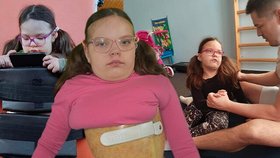 Valérii (10) odumírají svaly: Statečné dívce se SMA pomáhá neurorehabilitace