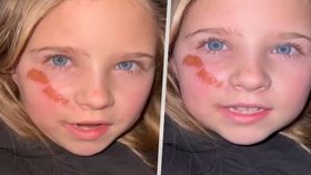 Zraněná ukrajinská holčička prosí Putina: Odvraťte svá vojska!