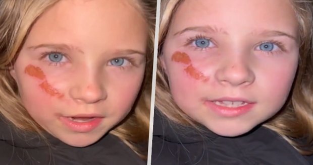 Video, ze kterého mrazí: Zraněná ukrajinská holčička prosí Putina