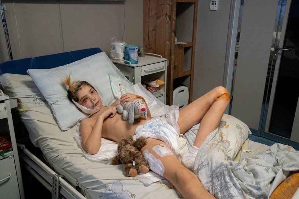 Volodymyr (12) přišel o brášku s tatínkem, sám leží v nemocnici.