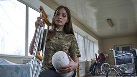 Ruslana (19) přišla v bojích o nohu. Ani přesto se nevzdala.