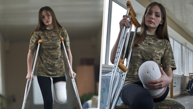 Ruslana (19) přišla v bojích o nohu. Ani přesto se nevzdala.